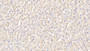 DAB staining on IHC-P; Samples: Bovine Liver Tissue; Primary Ab: 20μg/ml Rabbit Anti-Bovine IL12B Antibody Second Ab: 2µg/mL HRP-Linked Caprine Anti-Rabbit IgG Polyclonal Antibody