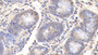 DAB staining on IHC-P; Samples: Bovine Colon Tissue; Primary Ab: 20μg/ml Rabbit Anti-Bovine IL12B Antibody Second Ab: 2µg/mL HRP-Linked Caprine Anti-Rabbit IgG Polyclonal Antibody