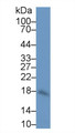 Western Blot; Sample: Human Leukocyte lysate; ; Primary Ab: 1µg/ml Rabbit Anti-Human IL10 Antibody; Second Ab: 0.2µg/mL HRP-Linked Caprine Anti-Rabbit IgG Polyclonal Antibody;