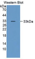 Western Blot; Sample: Recombinant protein.