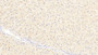 DAB staining on IHC-P; Samples: Human Liver Tissue;  Primary Ab: 20μg/ml Rabbit Anti-Human IGFBP4 Antibody Second Ab: 2µg/mL HRP-Linked Caprine Anti-Rabbit IgG Polyclonal Antibody 