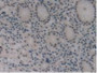 DAB staining on IHC-P; Samples: Human Stomach Tissue