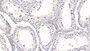 DAB staining on IHC-P; Samples: Bovine Testis Tissue;  Primary Ab: 20μg/ml Rabbit Anti-Bovine IGFBP1 Antibody Second Ab: 2µg/mL HRP-Linked Caprine Anti-Rabbit IgG Polyclonal Antibody 