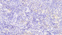 DAB staining on fromalin fixed paraffin- embedded lung tissue)