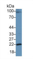 Western Blot; Sample: Rat Cerebrum lysate; Primary Ab: 3μg/ml Rabbit Anti-Rat GH Antibody; Second Ab: 0.2µg/mL HRP-Linked Caprine Anti-Rabbit IgG Polyclonal Antibody;