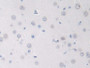 DAB staining on IHC-P; Samples: Rat Cerebrum Tissue;  Primary Ab: 10µg/ml Rabbit Anti-Rat GDNF Antib