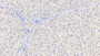 DAB staining on IHC-P; Samples: Human Liver Tissue;  Primary Ab: 10µg/ml Rabbit Anti-Human GDNF Antibody Second Ab: 2µg/mL HRP-Linked Caprine Anti-Rabbit IgG Polyclonal Antibody 