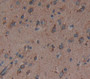 Colony Stimulating Factor 3, Granulocyte (Gcsf) Polyclonal Antibody, Cat#CAU28879