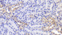 DAB staining on IHC-P; Samples: Mouse Kidney Tissue; Primary Ab: 20μg/ml Rabbit Anti-Mouse FN Antibody Second Ab: 2µg/mL HRP-Linked Caprine Anti-Rabbit IgG Polyclonal Antibody