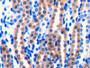 DAB staining on IHC-P; Samples: Mouse Kidney Tissue;  Primary Ab: 10µg/ml Rabbit Anti-Mouse FGF1 Ant