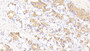 DAB staining on IHC-P; Samples: Human Stomach Tissue;  Primary Ab: 20μg/ml Rabbit Anti-Human FASL Antibody Second Ab: 2µg/mL HRP-Linked Caprine Anti-Rabbit IgG Polyclonal Antibody 
