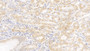 DAB staining on IHC-P; Samples: Human Stomach Tissue; Primary Ab: 10µg/ml Rabbit Anti-Human FAS Antibody Second Ab: 2µg/mL HRP-Linked Caprine Anti-Rabbit IgG Polyclonal Antibody