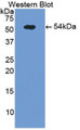 Western Blot; Sample: Recombinant protein.