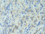 DAB staining on IHC-P; Samples: Rat Stomach Tissue;  Primary Ab: 20µg/ml Rabbit Anti-Rat CDHE Antibo