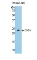 Western Blot; Sample: Recombinant protein.