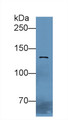 Western Blot; Sample: Rat Liver lysate; ; Primary Ab: 3µg/ml Rabbit Anti-Gallus CDHE Antibody; Second Ab: 0.2µg/mL HRP-Linked Caprine Anti-Rabbit IgG Polyclonal Antibody;