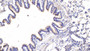 DAB staining on IHC-P; Samples: Rat Lung Tissue; Primary Ab: 10µg/ml Rabbit Anti-Rat CTGF Antibody Second Ab: 2µg/mL HRP-Linked Caprine Anti-Rabbit IgG Polyclonal Antibody