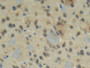 DAB staining on IHC-P; Samples: Mouse Cerebrum Tissue; Primary Ab: 20µg/ml Rabbit Anti-Mouse CTGF Antibody Second Ab: 2µg/mL HRP-Linked Caprine Anti-Rabbit IgG Polyclonal Antibody