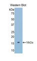 Western Blot; Sample: Recombinant protein.