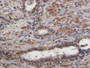 DAB staining on fromalin fixed paraffin-embedded Heart tissue)