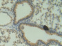 DAB staining on IHC-P; Samples: Mouse Lung Tissue; Primary Ab: 20µg/ml Rabbit Anti-Mouse ANG Antibody Second Ab: 2µg/mL HRP-Linked Caprine Anti-Rabbit IgG Polyclonal Antibody