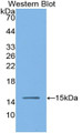 Western Blot; Sample: Recombinant protein.