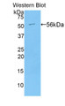 Western Blot; Sample: Recombinant protein.