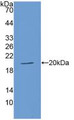 Western Blot; Sample: Recombinant ACE, Human.