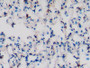 DAB staining on IHC-P; Samples: Rat Lung Tissue;  Primary Ab: 10µg/ml Rabbit Anti-Rat ALCAM Antibody