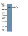 Corneodesmosin (CDSN) Polyclonal Antibody, CAU29049