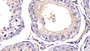 DAB staining on IHC-P; Sample: Bovine Testis Tissue;  Primary Ab: 20μg/ml Rabbit Anti-Bovine CSN3 Antibody Second Ab: 2µg/mL HRP-Linked Caprine Anti-Rabbit IgG Polyclonal Antibody 