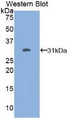 Western Blot; Sample: Recombinant protein.