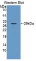 Western Blot; Sample: Recombinant protein.