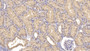 DAB staining on IHC-P; Samples: Human Kidney Tissue; Primary Ab: 10µg/ml Rabbit Anti-Human Bax Antibody Second Ab: 2µg/mL HRP-Linked Caprine Anti-Rabbit IgG Polyclonal Antibody