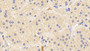 DAB staining on IHC-P; Samples: Human Adrenal gland Tissue; Primary Ab: 10ug/ml Rabbit Anti-Human Bax Antibody Second Ab: 2µg/mL HRP-Linked Caprine Anti-Rabbit IgG Polyclonal Antibody