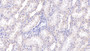 DAB staining on IHC-P; Samples: Human Kidney Tissue;  Primary Ab: 10µg/ml Rabbit Anti-Human RNASE2 Antibody Second Ab: 2µg/mL HRP-Linked Caprine Anti-Rabbit IgG Polyclonal Antibody 