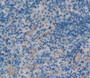 DAB staining on IHC-P; Samples：Human Spleen Tissue.