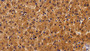DAB staining on IHC-P; Sample: Human Liver Tissue;  Primary Ab: 20ug/ml Mouse Anti-Human ALCAM Antibody Second Ab: 2µg/mL HRP-Linked Caprine Anti-Mouse IgG Polyclonal Antibody 