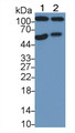 Western Blot; Sample: Lane1: Rat Serum; Lane2: Rat Plasma; Primary Ab: 2µg/mL Mouse Anti-Human AREG Antibody; Second Ab: 0.2µg/mL HRP-Linked Caprine Anti-Mouse IgG Polyclonal Antibody;
