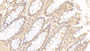 DAB staining on IHC-P; Samples: Human Colon Tissue;  Primary Ab: 20μg/ml Mouse Anti-Human ANGPT1 Antibody Second Ab: 2µg/mL HRP-Linked Caprine Anti-Mouse IgG Polyclonal Antibody 