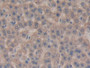 DAB staining on IHC-P; Samples: Rat Liver Tissue; Primary Ab: 20µg/ml Mouse Anti-Rat CTGF Antibody Second Ab: 2µg/mL HRP-Linked Caprine Anti-Mouse IgG Polyclonal Antibody