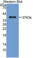 Western Blot; Sample: Recombinant protein.