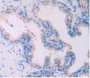 Figure. DAB staining on IHC-P; Samples: Human Prostate Gland Tissue.