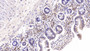 DAB staining on IHC-P; Samples: Rabbit Colon Tissue; Primary Ab: 40µg/ml Mouse Anti-Rabbit IL6 Antibody Second Ab: 2µg/mL HRP-Linked Caprine Anti-Mouse IgG Polyclonal Antibody