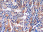 DAB staining on IHC-P; Samples: Rabbit Kidney Tissue;  Primary Ab: 20µg/ml Mouse Anti-Rabbit MCP1 An