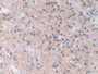 DAB staining on IHC-P; Samples: Human Appendix Tissue)