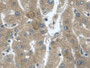 DAB staining on IHC-P; Samples: Human Liver Tissue; Primary Ab: 30µg/ml Mouse Anti-Human TGFa Antibody Second Ab: 2µg/mL HRP-Linked Caprine Anti-Mouse IgG Polyclonal Antibody