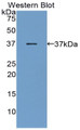 Western Blot; Sample: Recombinant protein.