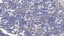 DAB staining on IHC-P; Samples: Human Pancreas Tissue;  Primary Ab: 40µg/ml Mouse Anti-Human AMH Antibody Second Ab: 2µg/mL HRP-Linked Caprine Anti-Mouse IgG Polyclonal Antibody 