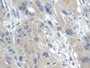 DAB staining on IHC-P; Samples: Human Esophagus Tissue; Primary Ab: 30µg/ml Mouse Anti-Human GAL2 Antibody Second Ab: 2µg/mL HRP-Linked Caprine Anti-Mouse IgG Polyclonal Antibody